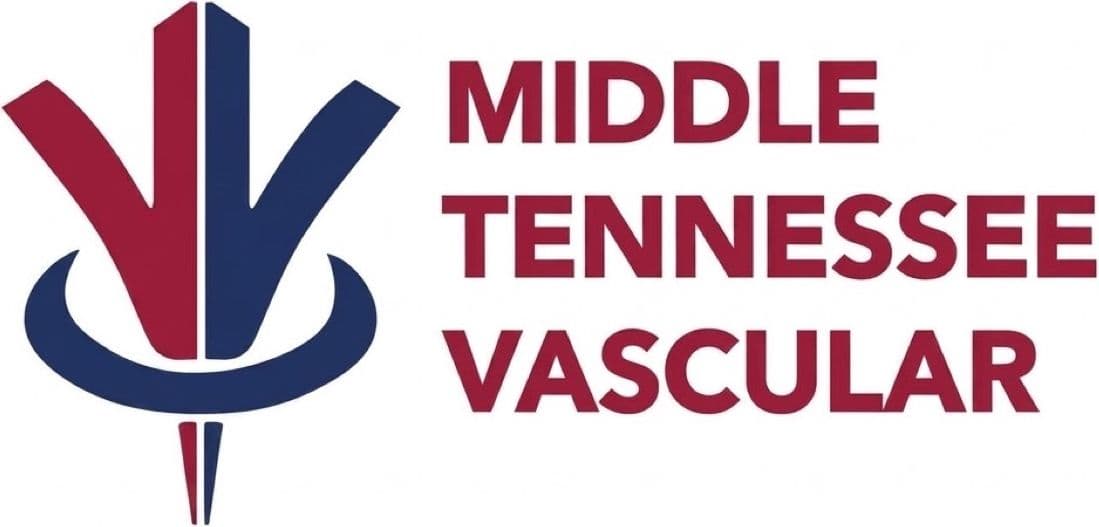 Middle Tennessee Vascular